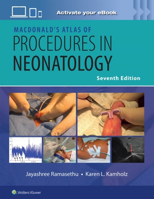 MacDonald’s Atlas of Procedures in Neonatology Print + eBook with Multimedia