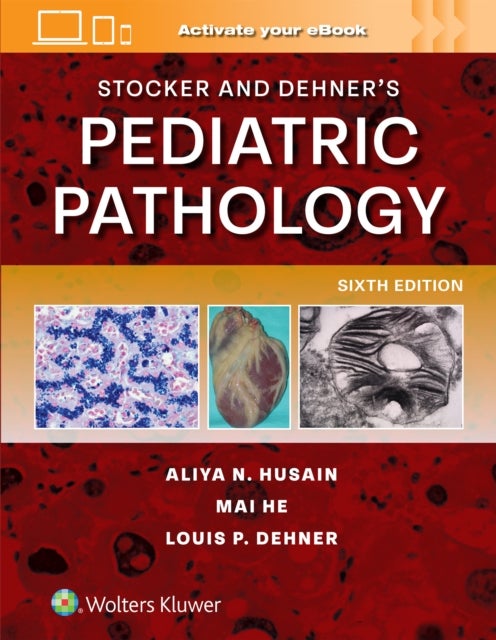 Stocker and Dehner's Pediatric Pathology