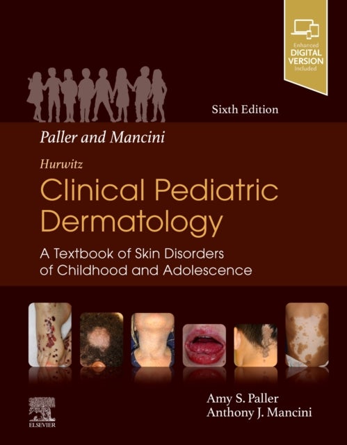 Mancini and Paller - Hurwitz Clinical Pediatric Dermatology - A Textbook of Skin Disorders of Childhood & Adolescence