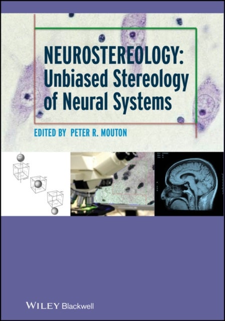Neurostereology - Unbiased Stereology of Neural Systems