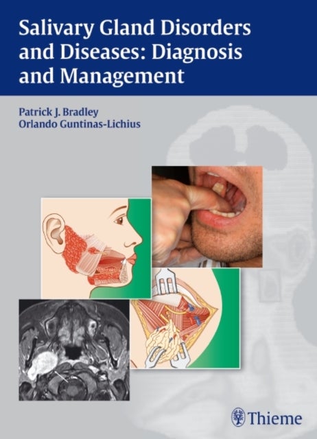 Salivary Gland Disorders and Diseases: - Diagnosis and Management