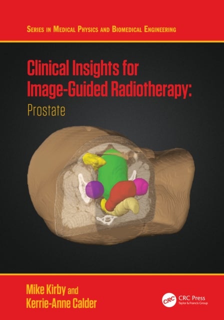 Clinical Insights for Image-Guidance Radiation Therapy - Prostate
