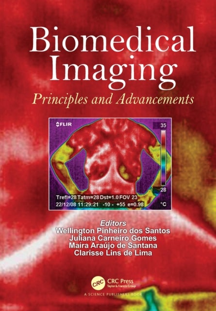 Biomedical Imaging - Principles and Advancements