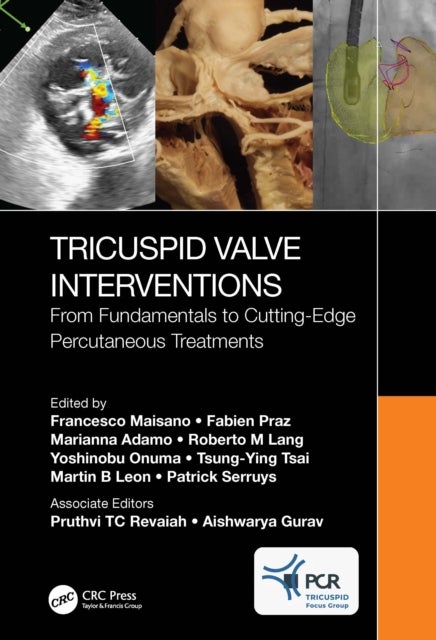 Tricuspid Valve Interventions - From Fundamentals to Cutting-Edge Percutaneous Treatments