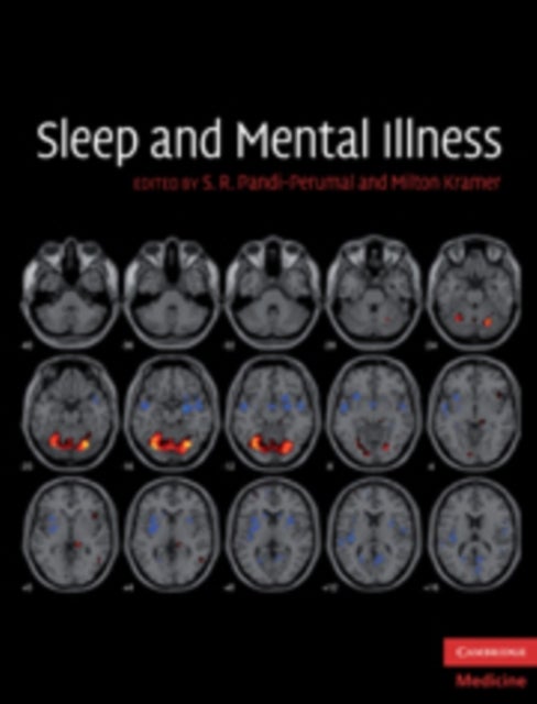 Sleep and Mental Illness