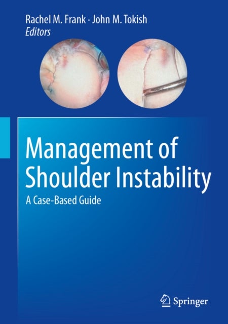Management of Shoulder Instability - A Case-Based Guide