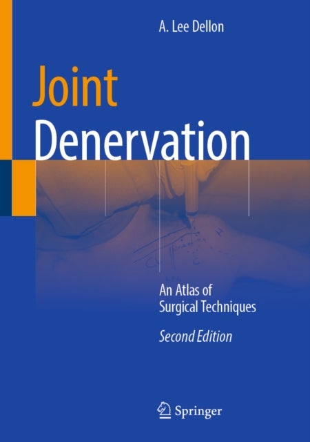 Joint Denervation - An Atlas of Surgical Techniques