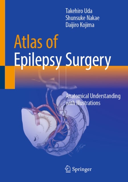 Atlas of Epilepsy Surgery - Anatomical Understanding with Illustrations