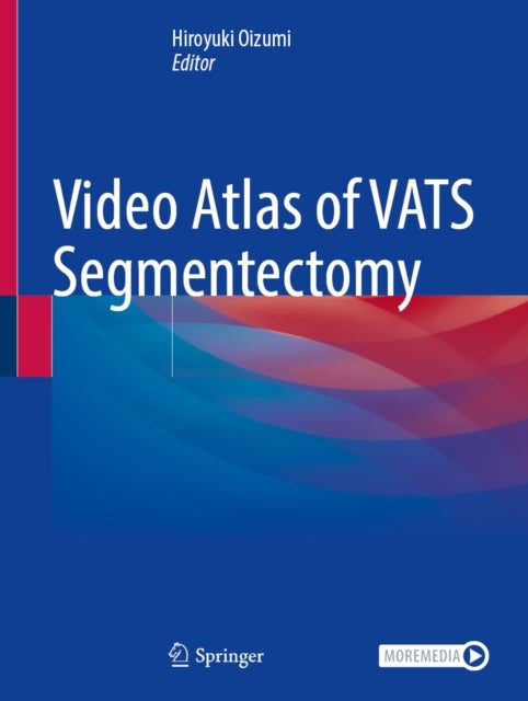 Video Atlas of VATS Segmentectomy
