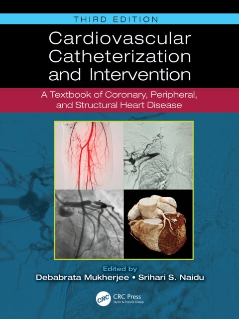 Cardiovascular Catheterization and Intervention - A Textbook of Coronary, Peripheral, and Structural Heart Disease