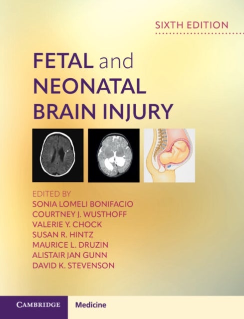 Fetal and Neonatal Brain Injury