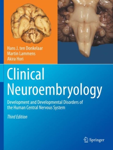 Clinical Neuroembryology - Development and Developmental Disorders of the Human Central Nervous System
