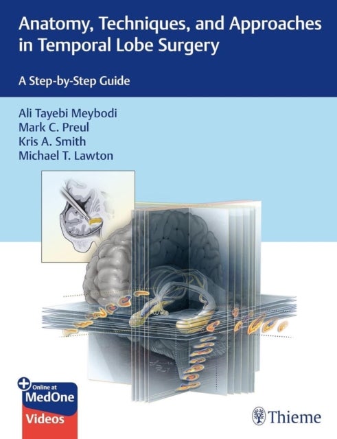 Anatomy, Techniques, and Approaches in Temporal Lobe Surgery - A Step-by-Step Guide