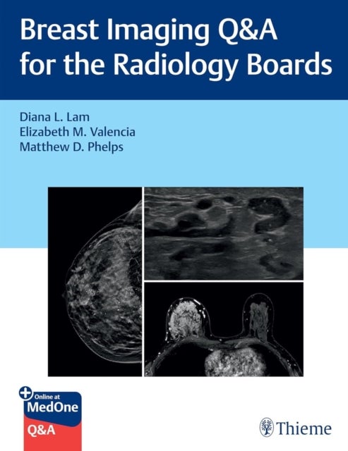 Breast Imaging Q&a for the Radiology Boards