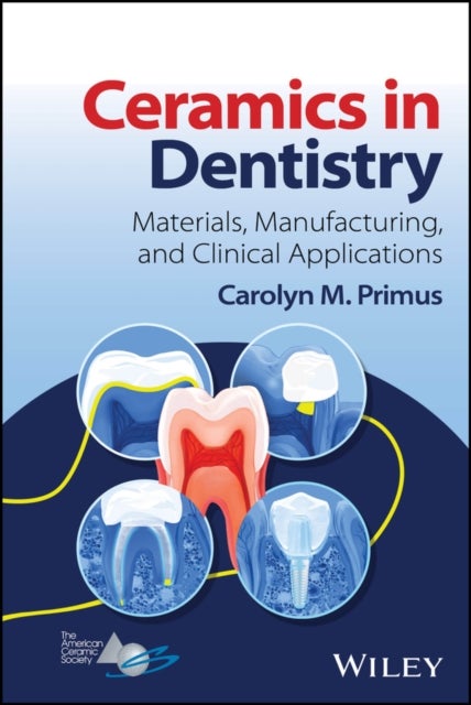 Ceramics in Dentistry - Materials, Manufacturing, and Clinical Applications