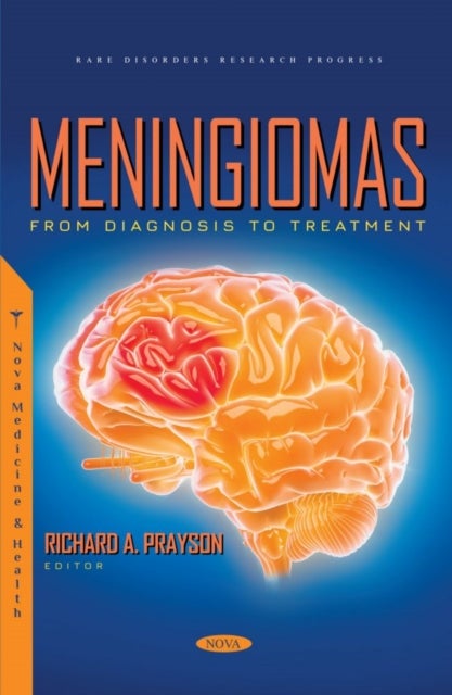 Meningiomas - From Diagnosis to Treatment
