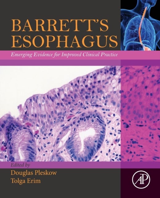 Barrett’s Esophagus - Emerging Evidence for Improved Clinical Practice