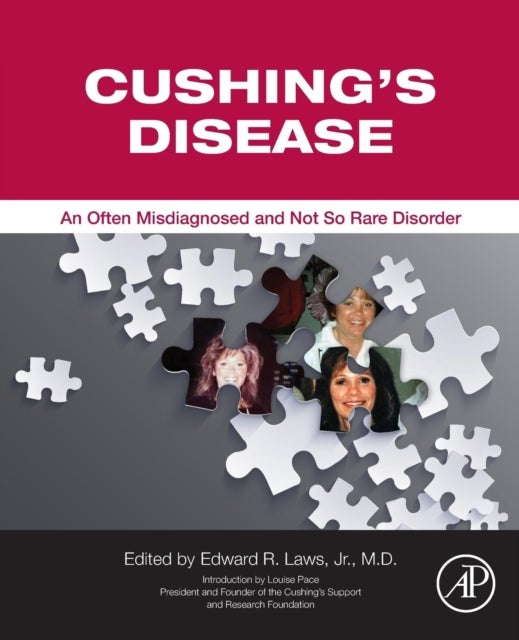 Cushing's Disease - An Often Misdiagnosed and Not So Rare Disorder