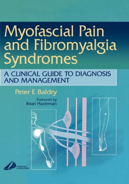 Myofascial Pain and Fibromyalgia Syndromes - A Clinical Guide to Diagnosis and Management