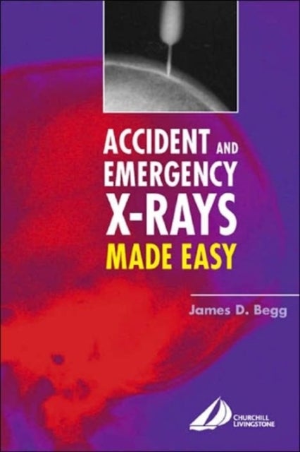 Accident and Emergency X-Rays Made Easy - Accident and Emergency X-Rays Made Easy