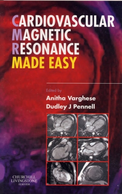 Cardiovascular Magnetic Resonance Made Easy