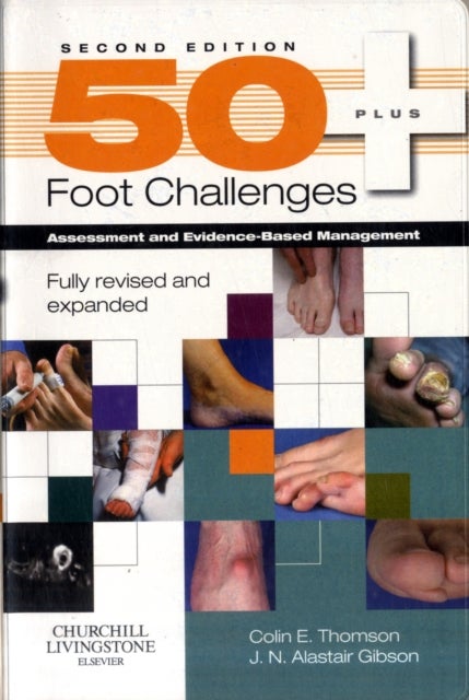 50+ Foot Challenges - Assessment and Evidence-Based Management