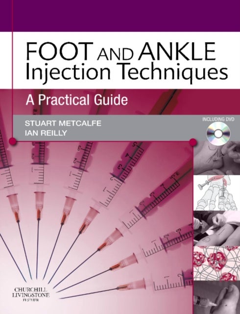 Foot and Ankle Injection Techniques - A Practical Guide