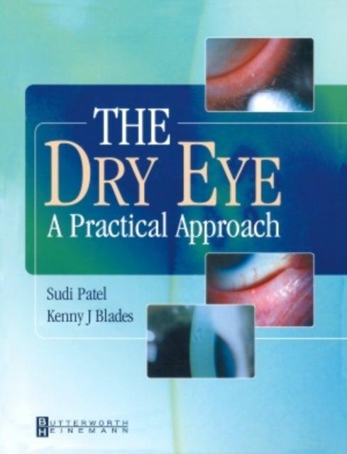 The Dry Eye - A Practical Approach