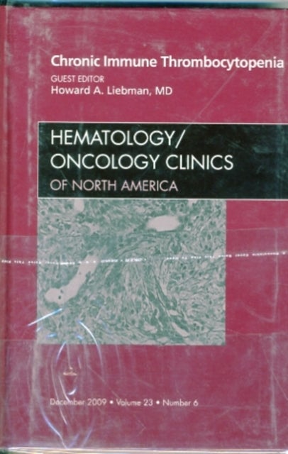 Chronic Immune Thrombocytopenia, An Issue of Hematology/Oncology Clinics of North America