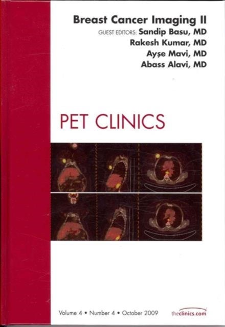 Breast Cancer Imaging II, An Issue of PET Clinics