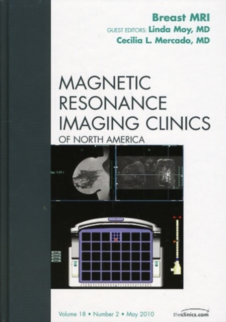 Breast MRI, An Issue of Magnetic Resonance Imaging Clinics
