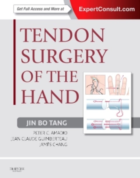 Tendon Surgery of the Hand - Expert Consult - Online and Print