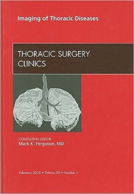 Imaging of Thoracic Diseases, An Issue of Thoracic Surgery Clinics