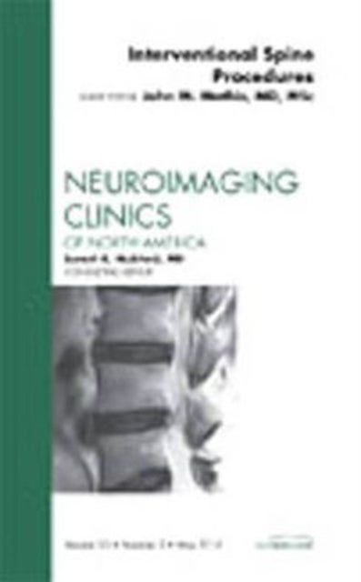 Image-Guided Spine Interventions, An Issue of Neuroimaging Clinics