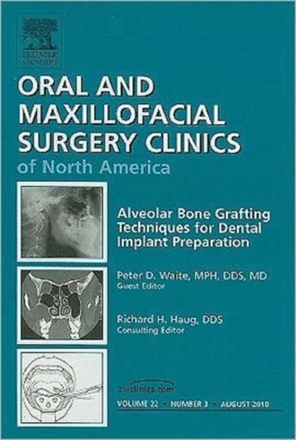 Alveolar Bone Grafting Techniques for Dental Implant Preparation, An Issue of Oral and Maxillofacial Surgery Clinics
