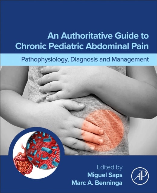 An Authoritative Guide to Chronic Pediatric Abdominal Pain - Pathophysiology, Diagnosis and Management