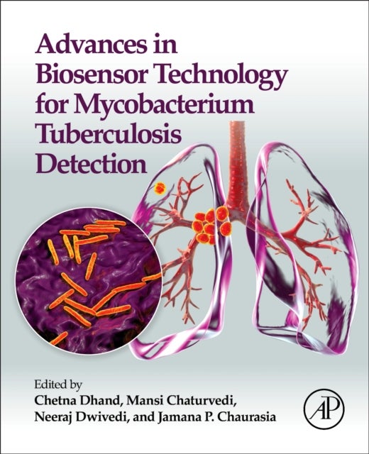 Advances in Biosensor Technology for Mycobacterium Tuberculosis Detection