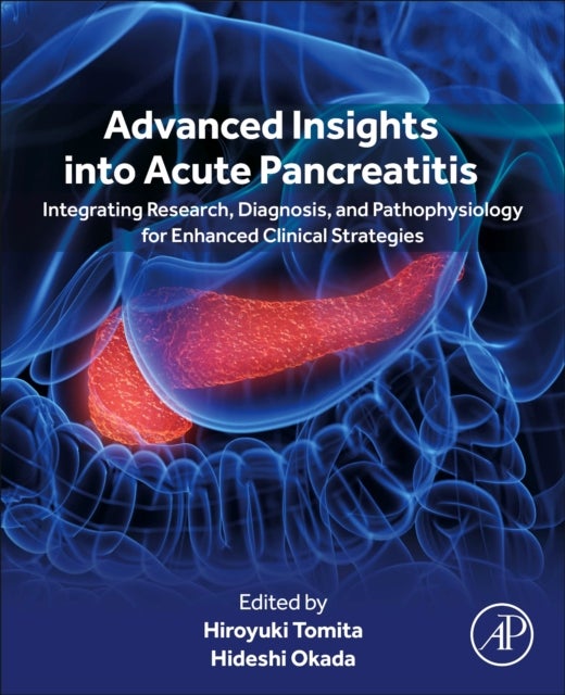 Advanced Insights into Acute Pancreatitis - Integrating Research, Diagnosis, and Pathophysiology for Enhanced Clinical Strategies