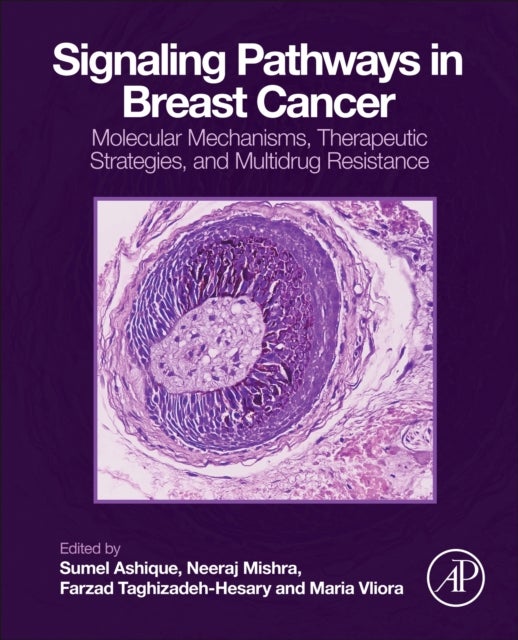 Signaling Pathways in Breast Cancer - Molecular Mechanisms, Therapeutic Strategies, and Multidrug Resistance
