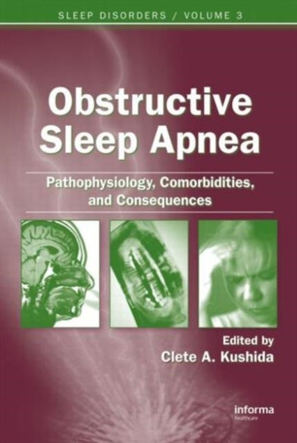 Obstructive Sleep Apnea - Pathophysiology, Comorbidities, and Consequences