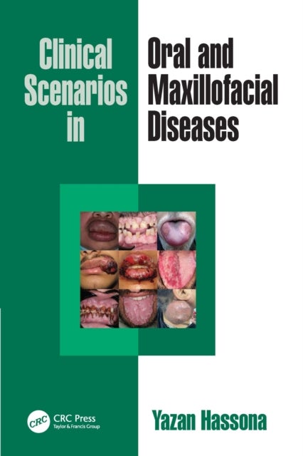 Clinical Scenarios in Oral and Maxillofacial Diseases