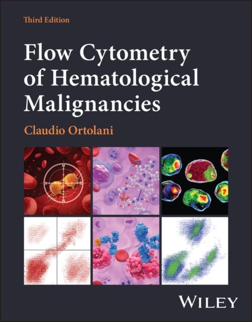 Flow Cytometry of Hematological Malignancies, 3rd Edition av Claudio Ortolani