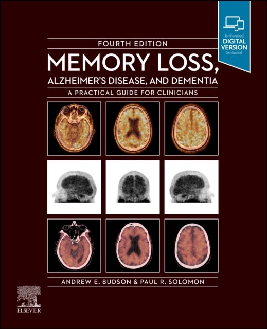 Memory Loss, Alzheimer's Disease and Dementia: A Practical Guide for Clinicians - A Practical Guide for Clinicians