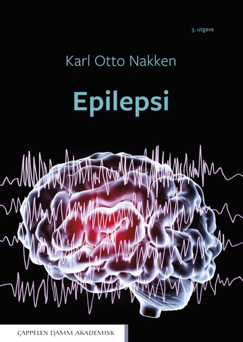 Epilepsi
