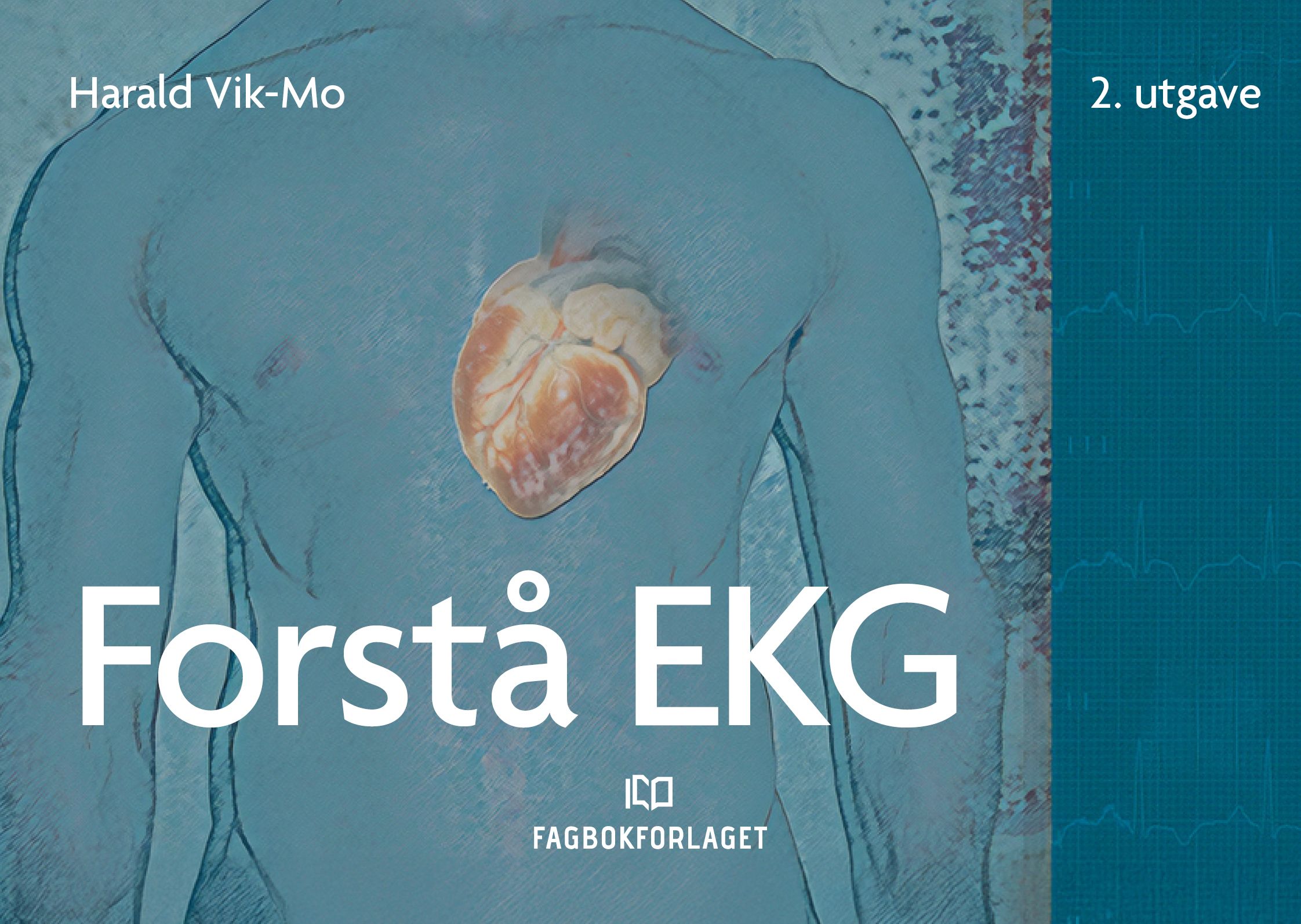 Forstå EKG