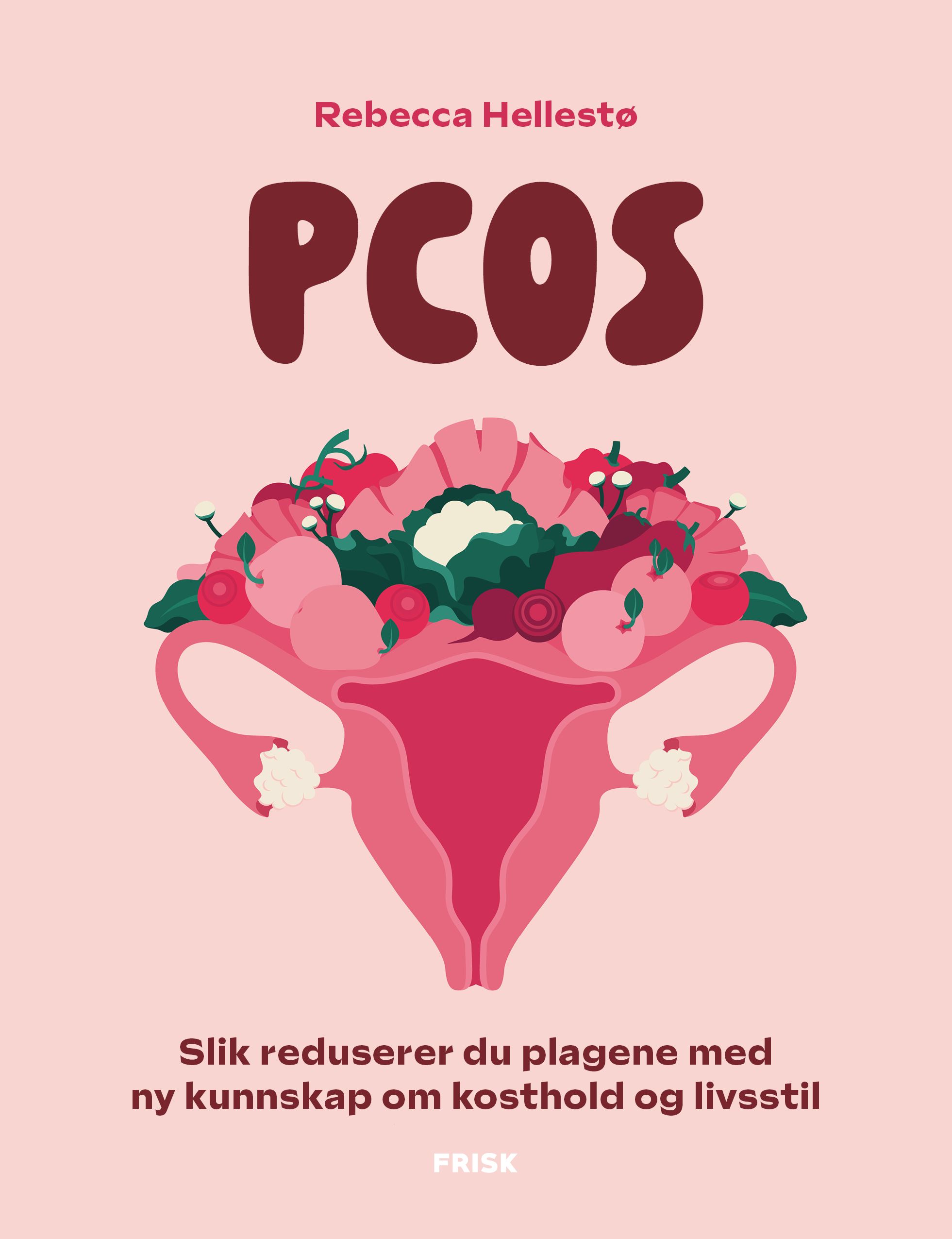 PCOS - slik reduserer du plagene med ny kunnskap om kosthold og livsstil