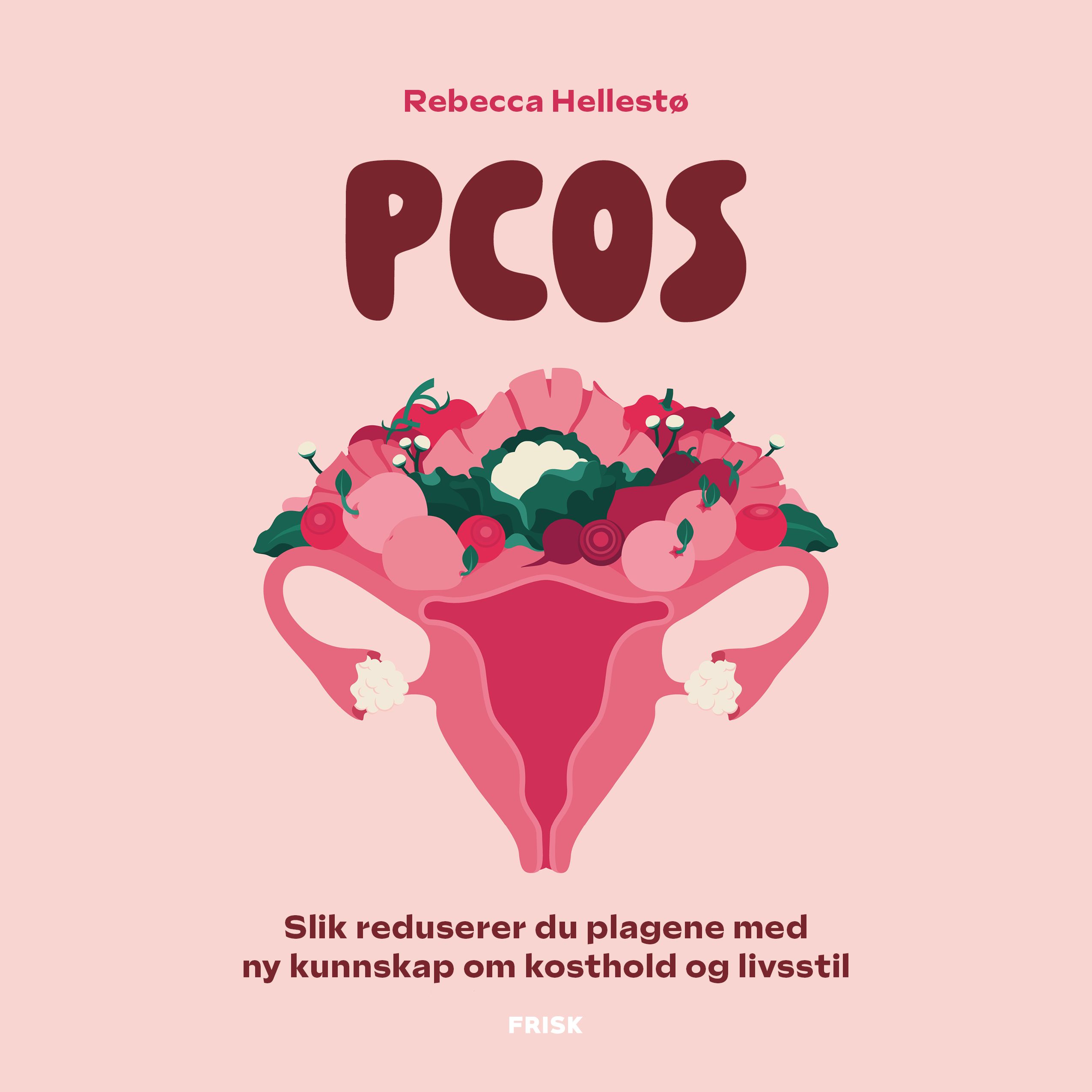 PCOS - slik reduserer du plagene med ny kunnskap om kosthold og livsstil