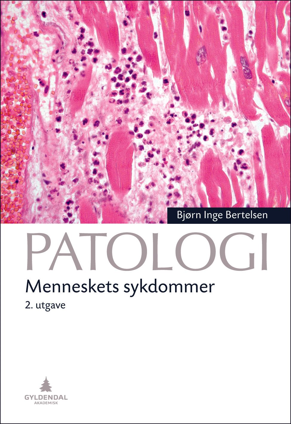 Patologi - menneskets sykdommer