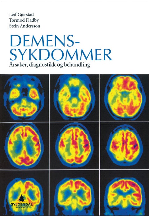 Demenssykdommer - årsaker, diagnostikk og behandling