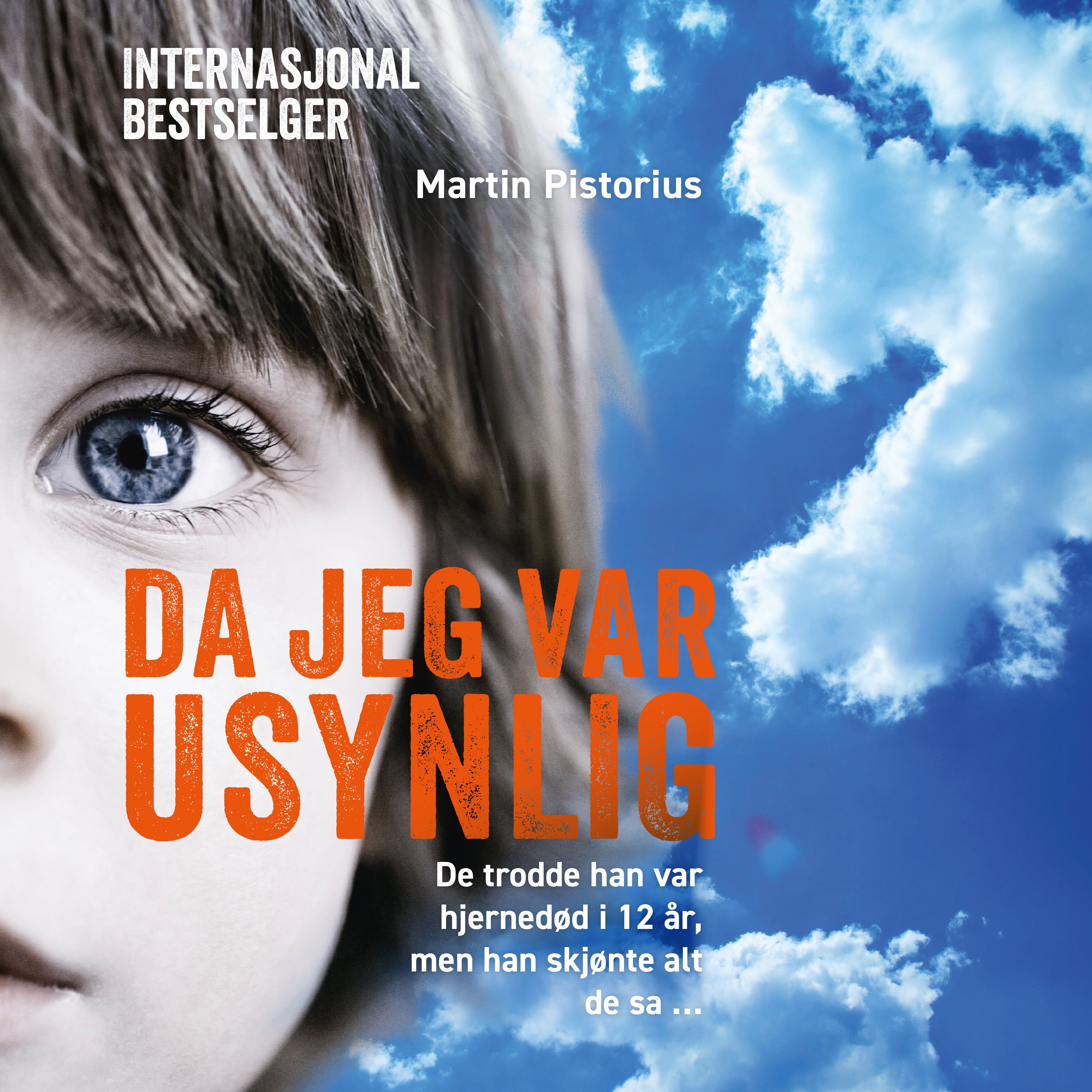 Da jeg var usynlig - de trodde han var hjernedød, men han skjønte alt de sa